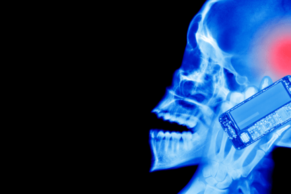 grafika przedstawiająca zdjęcie rentgenowskie człowieka rozmawiającego przez telefon komórowy